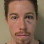 Snowboarder Shaun White sports a black eye in his mug shot released by the Nashville, Tenn. police department. (photo: Nashville PD)